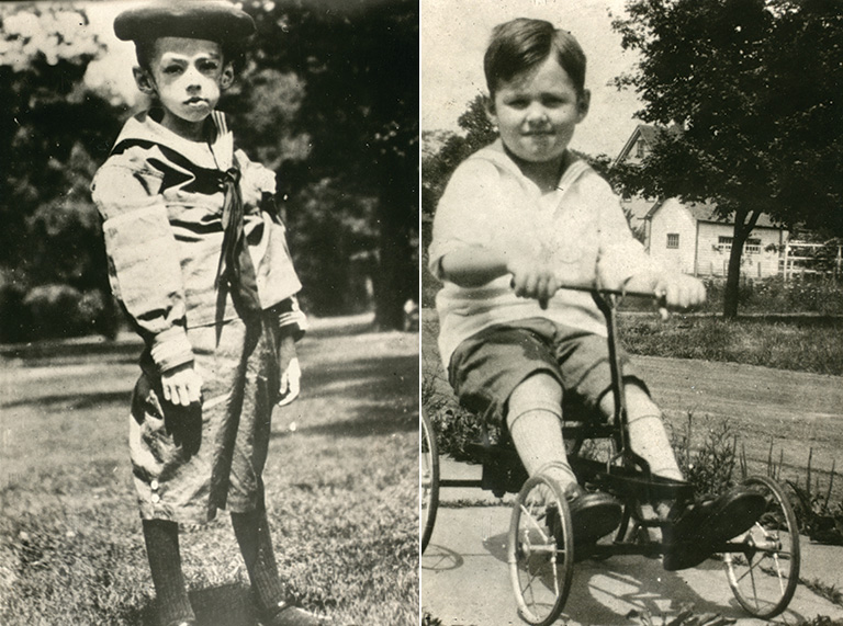 Teddy Ryder before and after receiving insulin in 1922